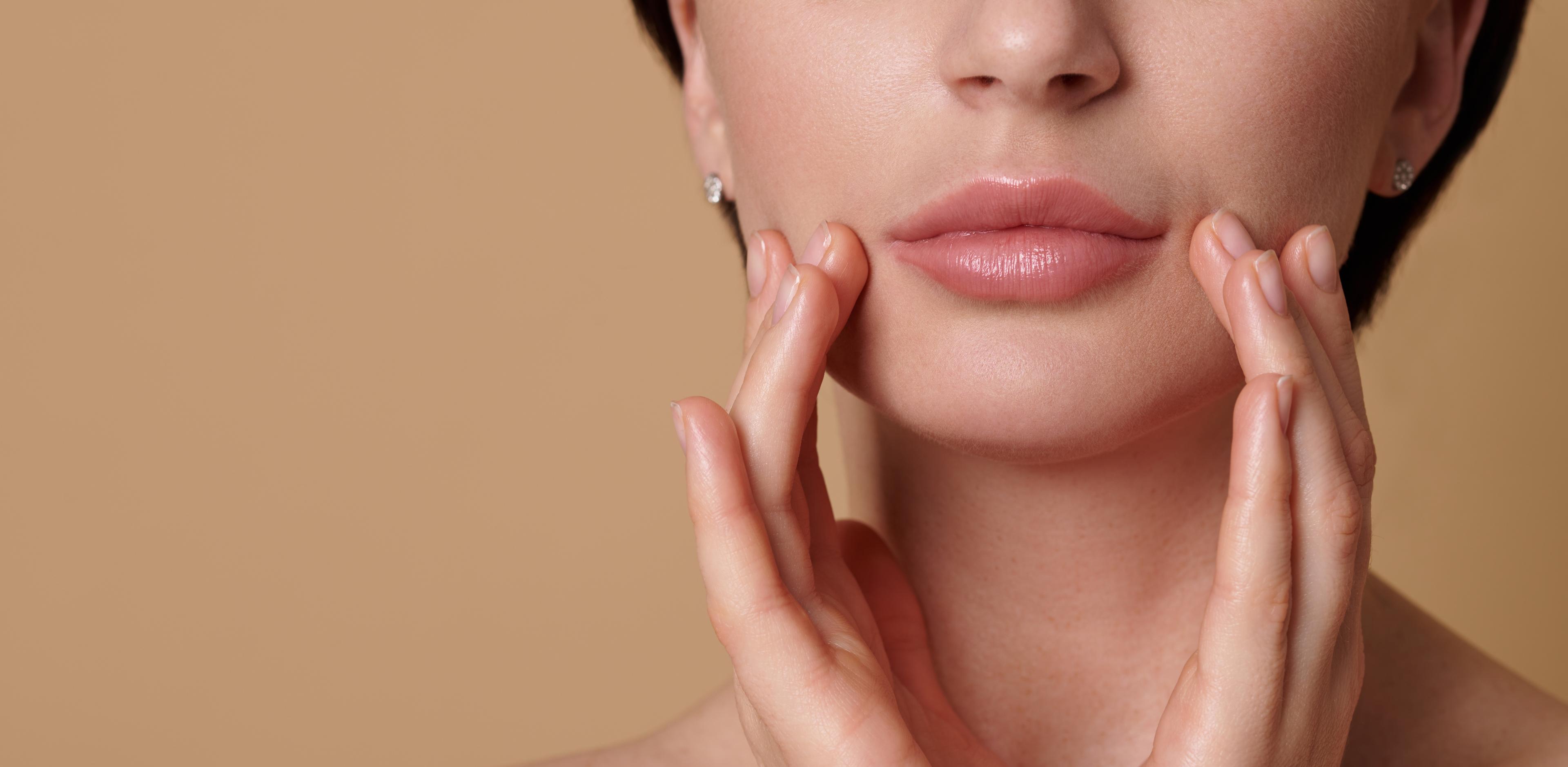 Lip Filler result 2