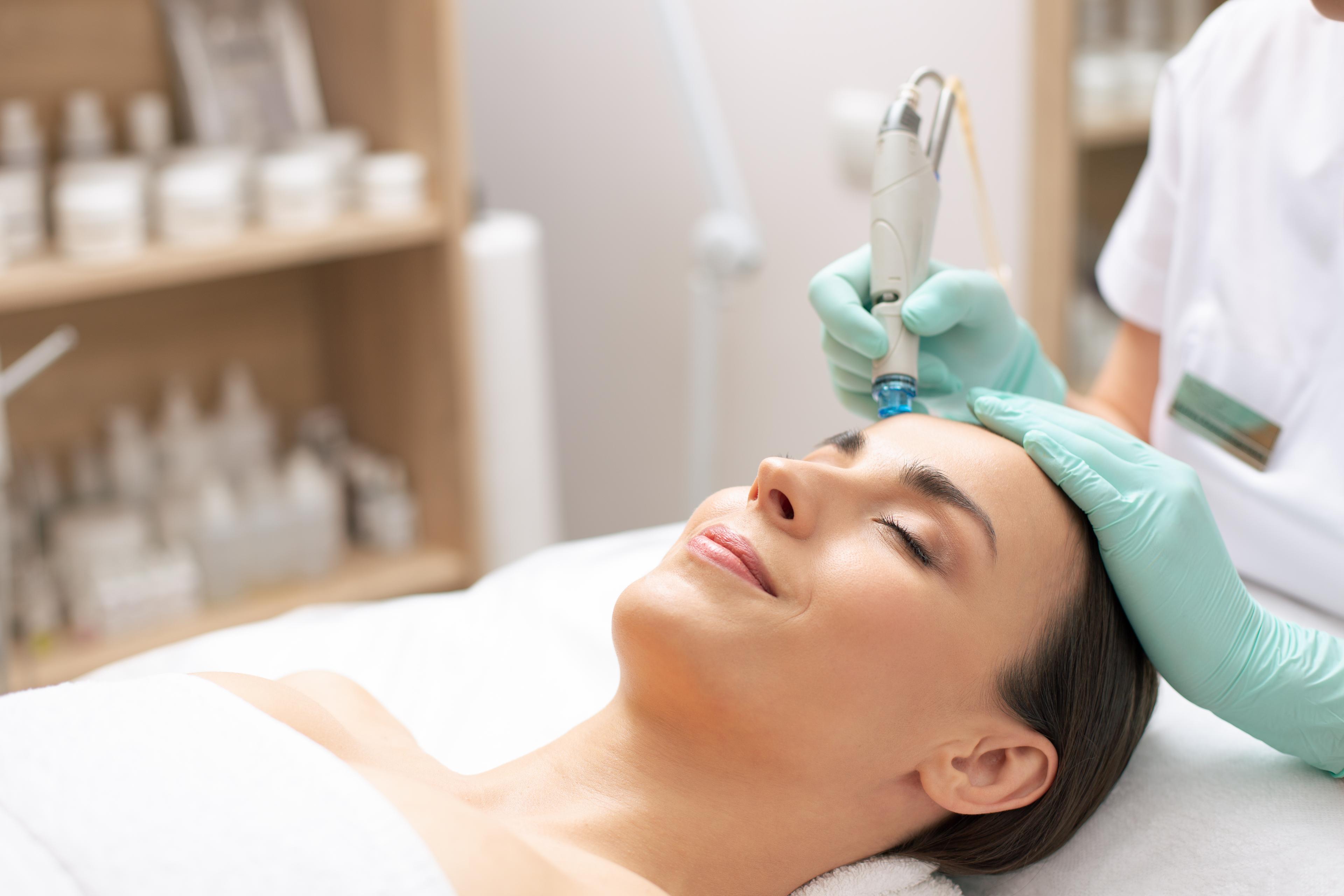 Microneedling result 2