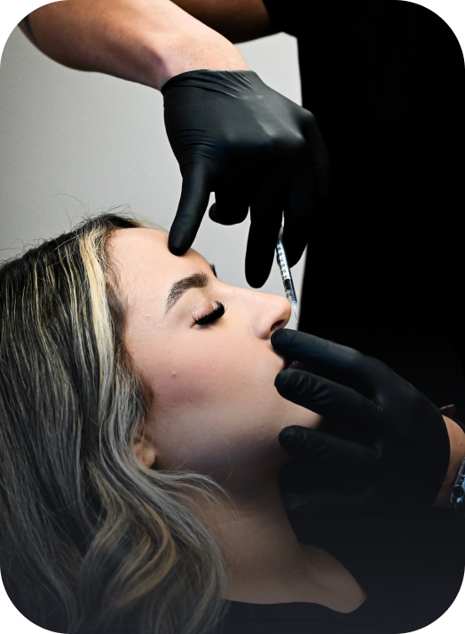 Facial Fillers